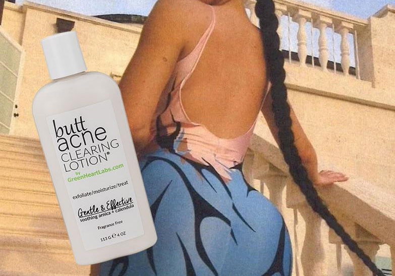 when the going gets tough with “buttne,” try clarifying your butt with this lotion