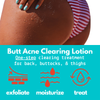 Green Heart Labs Skin Care Butt Acne Clearing Lotion ® | 2-pack